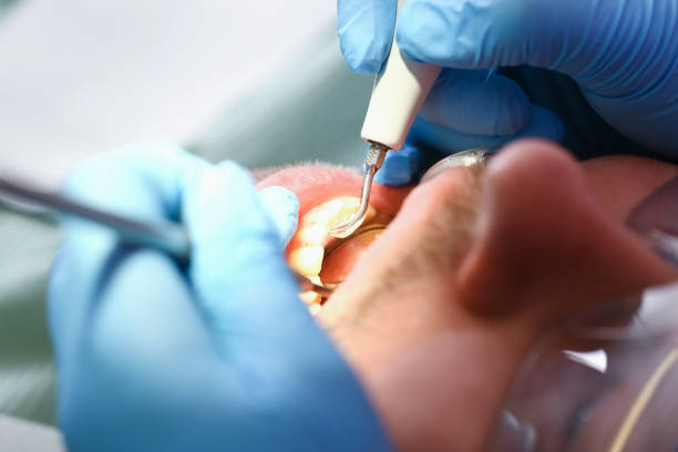 Best Broken Tooth Emergency  in River Falls, WI